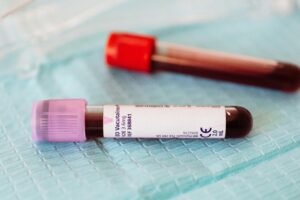 Anemia: Understanding the Blood Disorder